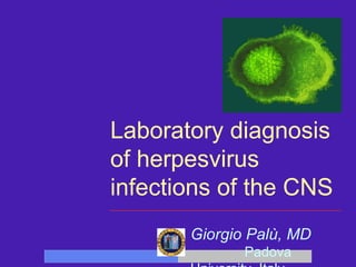 Laboratory diagnosis of herpesvirus infections of the CNS Giorgio Palù, MD   Padova University, Italy 