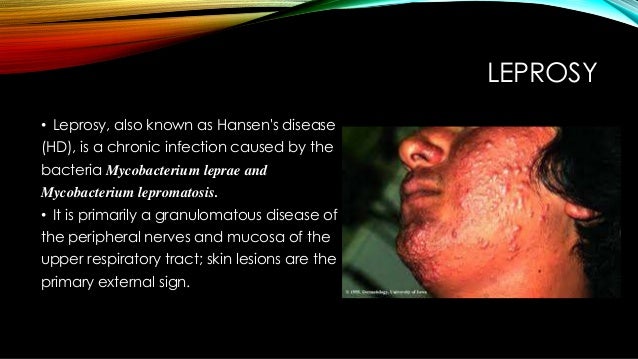 Laboratory diagnosis of leprosy