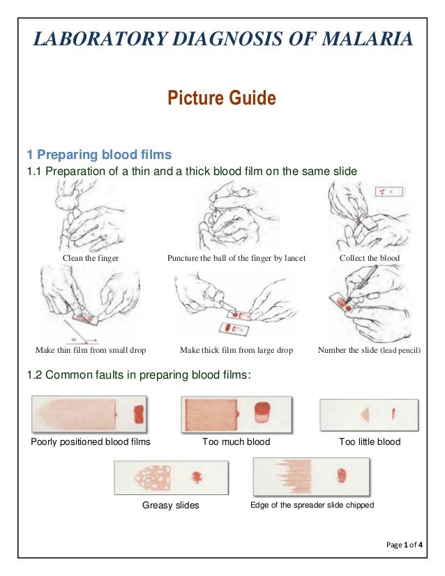 Laboratory diagnosis of malaria