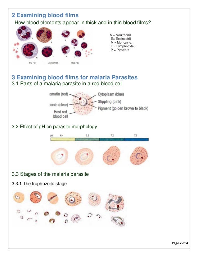 Laboratory diagnosis of malaria