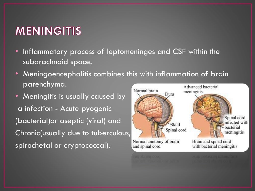 Laboratory diagnosis of meningitis