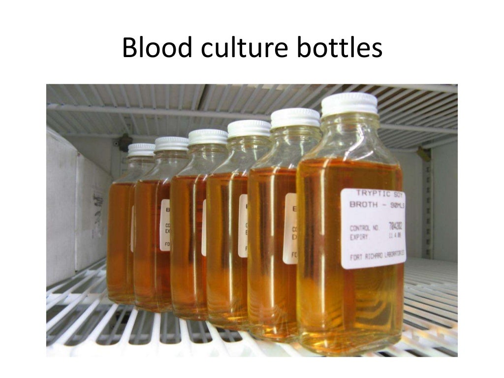 Laboratory diagnosis of salmonella