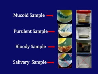 Tb Sample Types Laboratory diagnosis of Tuberculosis | PPTX