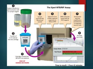 Tb Testing Simulation Lab Laboratory diagnosis of Tuberculosis gs | PPT