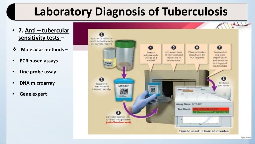 Laboratory diagnosis of tuberculosis pract.