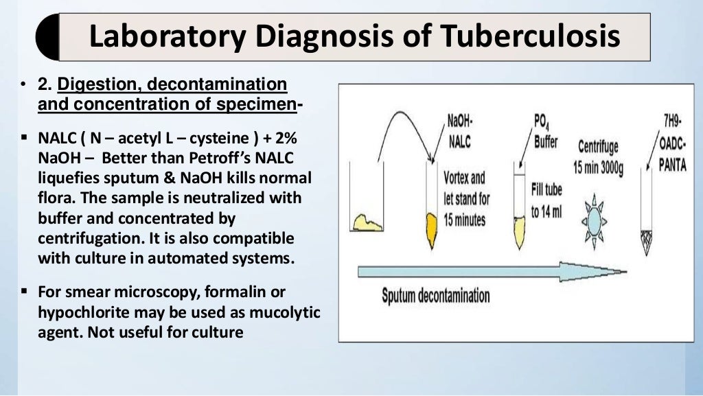 Laboratory diagnosis of tuberculosis pract.