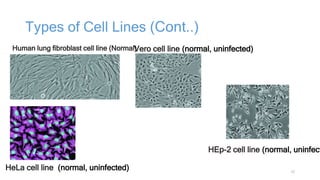 LABORATORY DIAGNOSIS OF VIRAL INFECTION.pptx