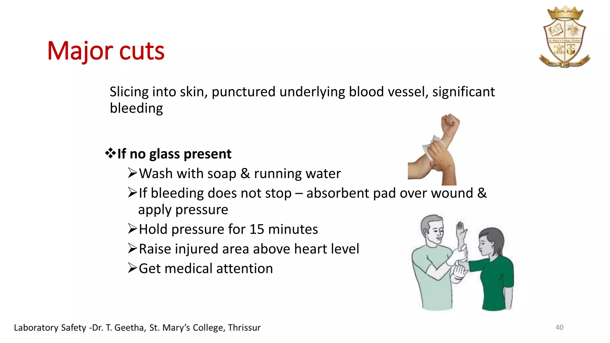 Major cuts
Slicing into skin, punctured underlying blood vessel, significant
bleeding
❖If no glass present
➢Wash with soap & running water
➢If bleeding does not stop – absorbent pad over wound &
apply pressure
➢Hold pressure for 15 minutes
➢Raise injured area above heart level
➢Get medical attention
40
 