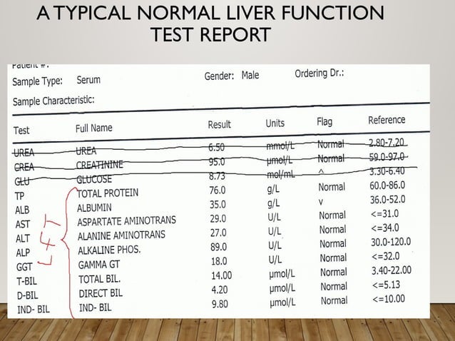 laboratory investigationS -LFT& RFT.pptx