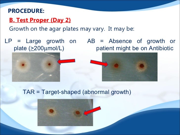 Laboratory procedure of bacterial inhibition assay