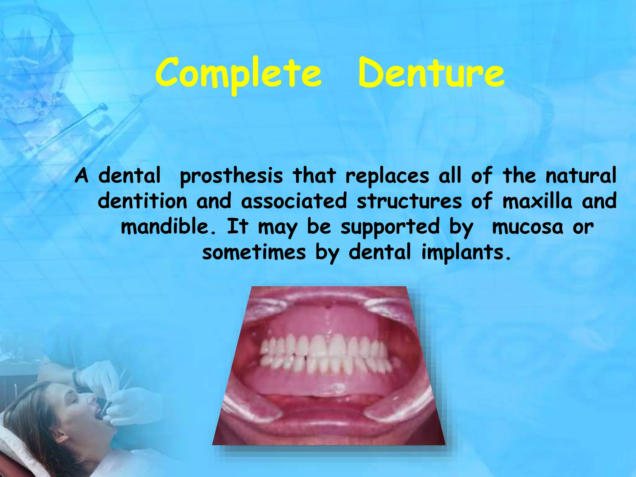 Full Denture Process laboratory procedures in make of complete denture | PPTX