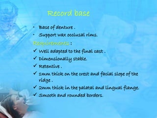 laboratory procedures in make of complete denture | PPTX