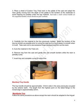 4
3. Place a sheet of Custom Tray Triad resin in the palate of the cast and adapt the
resin gently moving from the depth of the palate to the borders of the vestibules to
avoid trapping air bubbles under the tray material. And make a small vertical handle (or
45o angulated handle) which should not pull vestibule.
4. Carefully trim the material to the line previously marked. Make the borders of the
tray as smooth as possible prior to curing the resin as it is much easier to smooth when
it is soft. Take care not to use excessive finger pressure and thin out the resin.
5. Cure the material in the Triad unit.
6. Remove tray from the cast and gently trim and smooth borders while the resin is
partially cured.
7. Invert tray and complete curing for extra time
Maxillary Tray Handle
The tray handle should be approximately 3-5mm wide in the area previously occupied
by the anterior teeth. The length from the highest point on the labial flange to the
incisal edge is approximately 22mm.
Mandibular Tray
Follow the same procedure as above except the resin should be adapted to the lingual
 