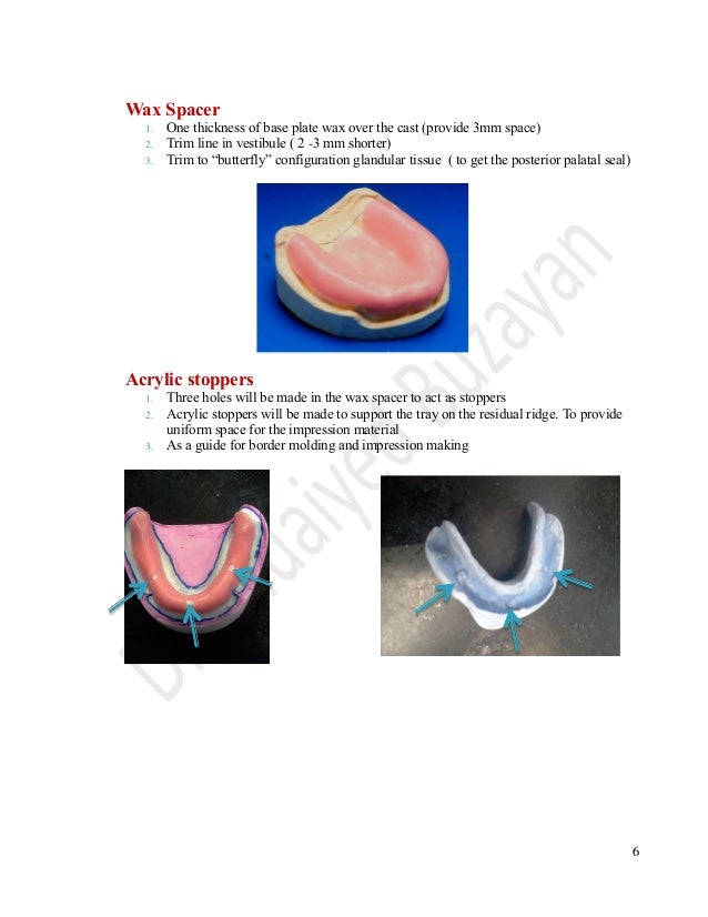 Laboratory procedures special tray construction lab