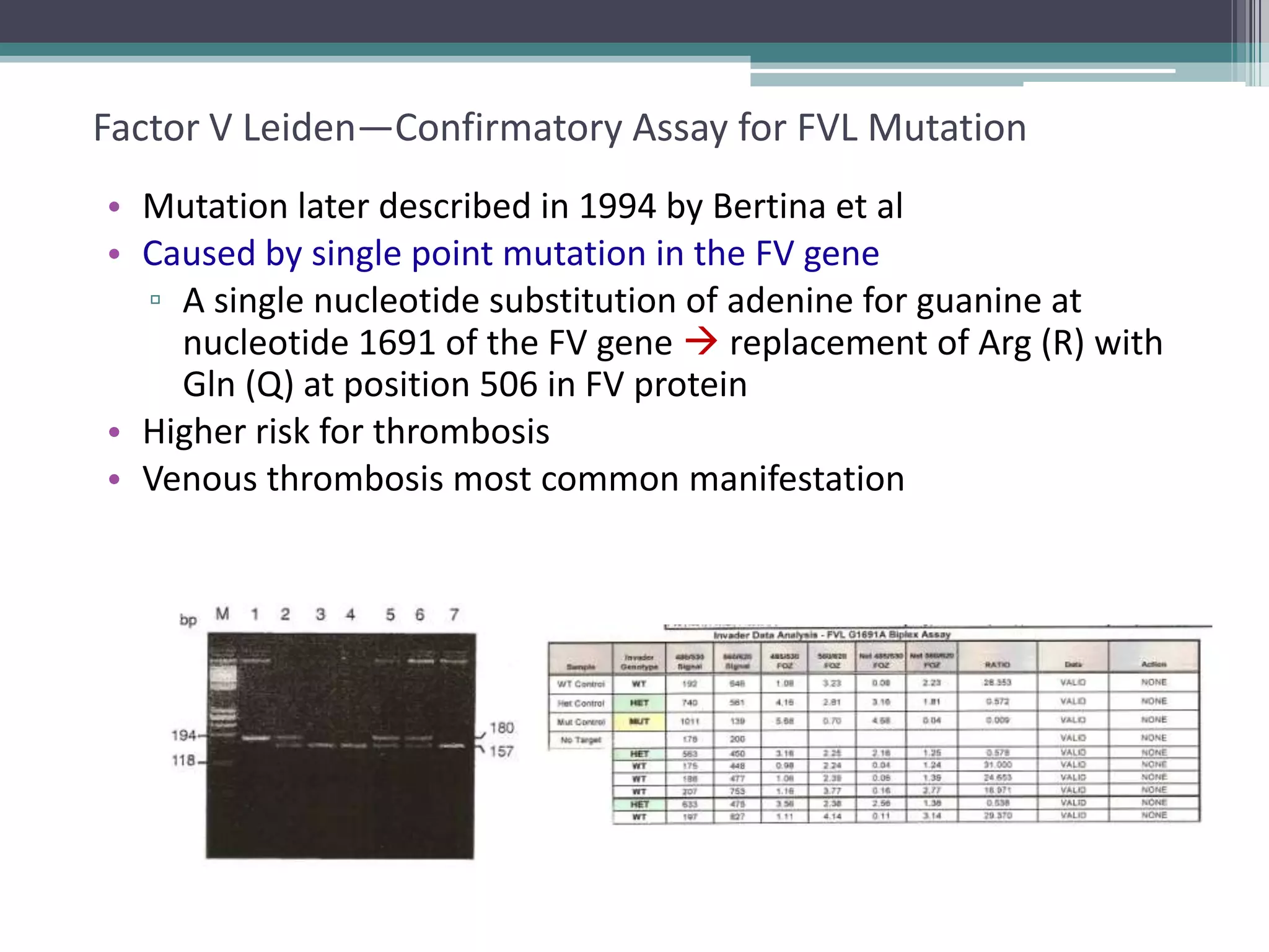 26

Factor V Leiden—Confirmatory Assay for FVL Mutation
• Mutation later described in 1994 by Bertina et al
• Caused by single point mutation in the FV gene
▫ A single nucleotide substitution of adenine for guanine at
nucleotide 1691 of the FV gene  replacement of Arg (R) with
Gln (Q) at position 506 in FV protein
• Higher risk for thrombosis
• Venous thrombosis most common manifestation

 