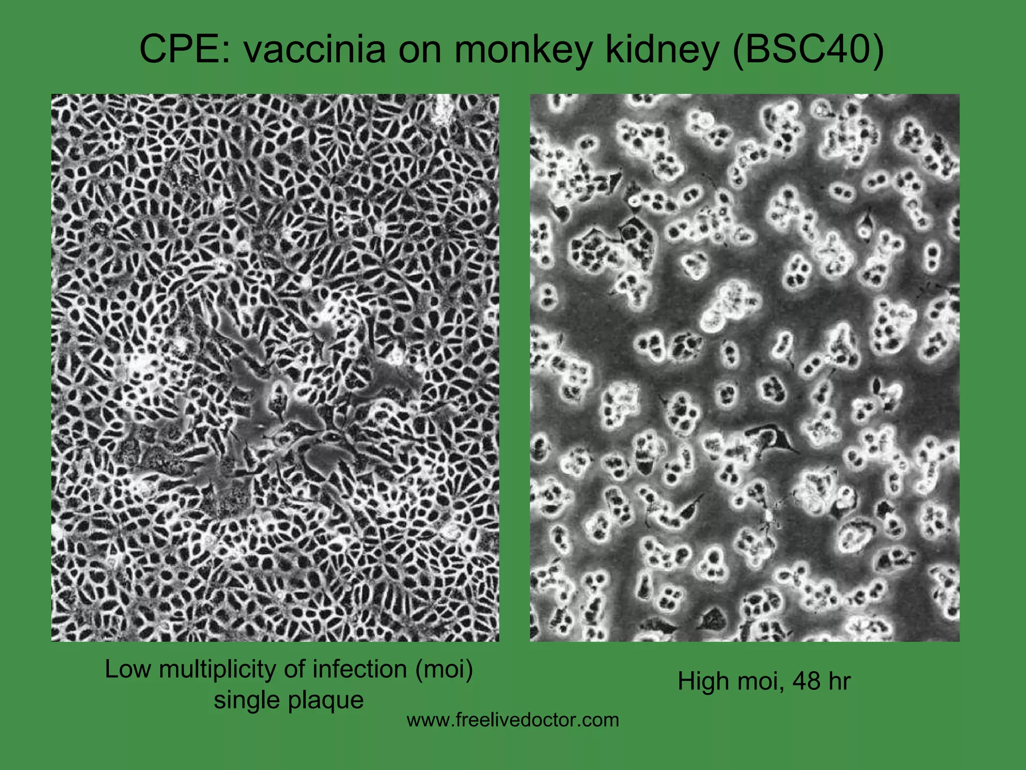 CPE: vaccinia on monkey kidney (BSC40) Low multiplicity of infection (moi) single plaque High moi, 48 hr www.freelivedoctor.com 