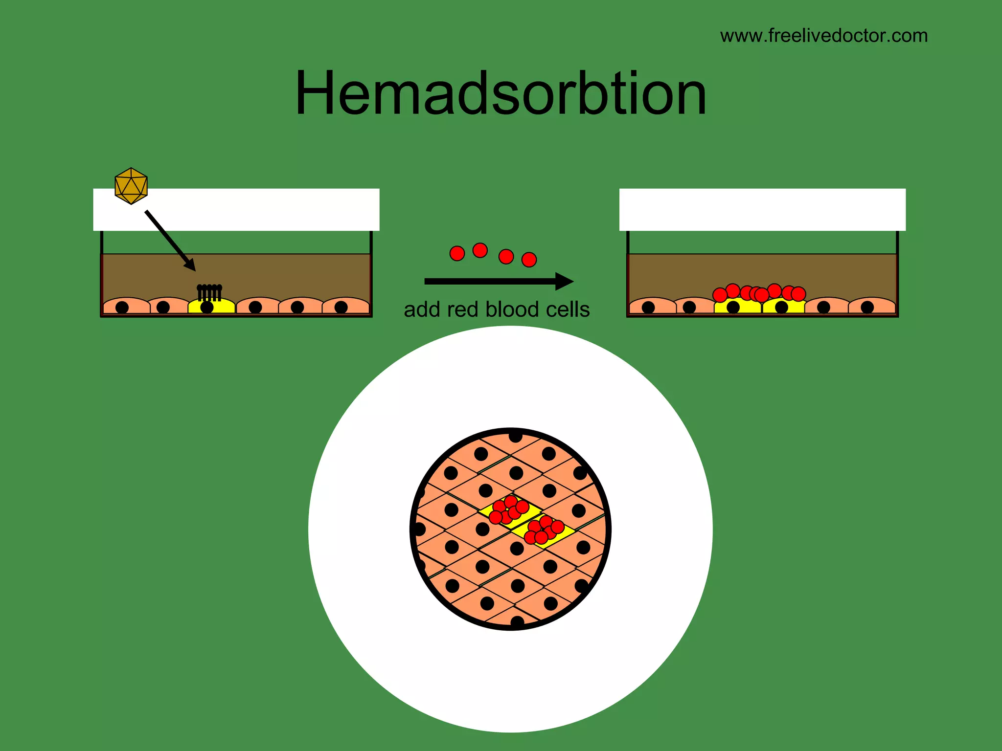 Hemadsorbtion www.freelivedoctor.com add red blood cells 