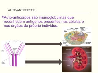 AUTO-ANTICORPOS
Auto-anticorpos são imunoglobulinas que
reconhecem antígenos presentes nas células e
nos órgãos do próprio indivíduo.
 