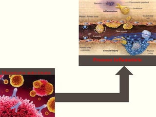 Processo Inflamatório
Mecanismo auto-imune
 