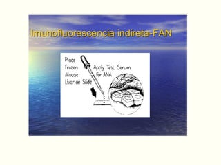 Imunofluorescencia indireta-FANImunofluorescencia indireta-FAN
 
