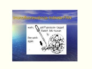 Imunofluorescência Indireta-FANImunofluorescência Indireta-FAN
 