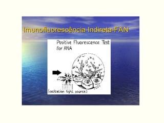 Imunofluorescência Indireta-FANImunofluorescência Indireta-FAN
 