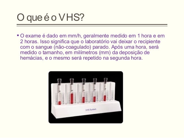 Exame vhs