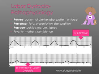 › Powers- abnormal uterine labor pattern or force
› Passenger- fetal presentation, size, position
› Passage- pelvic structure, tissues
› Psyche- mother’s confidence A- Effective
B- Ineffecive- Labor
Dystocia www.studyblue.com
 