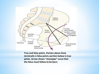 True and false pelvis. Portion above linea
terminalis is false pelvis; portion below is true
pelvis. Arrow shows “stovepipe” curve that
the fetus must follow to be born.
 