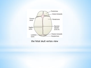 the fetal skull vertex view
 