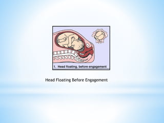 Head Floating Before Engagement
 