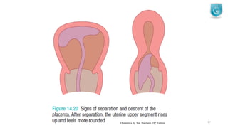 Normal Labour and Abnormal Labour | PDF