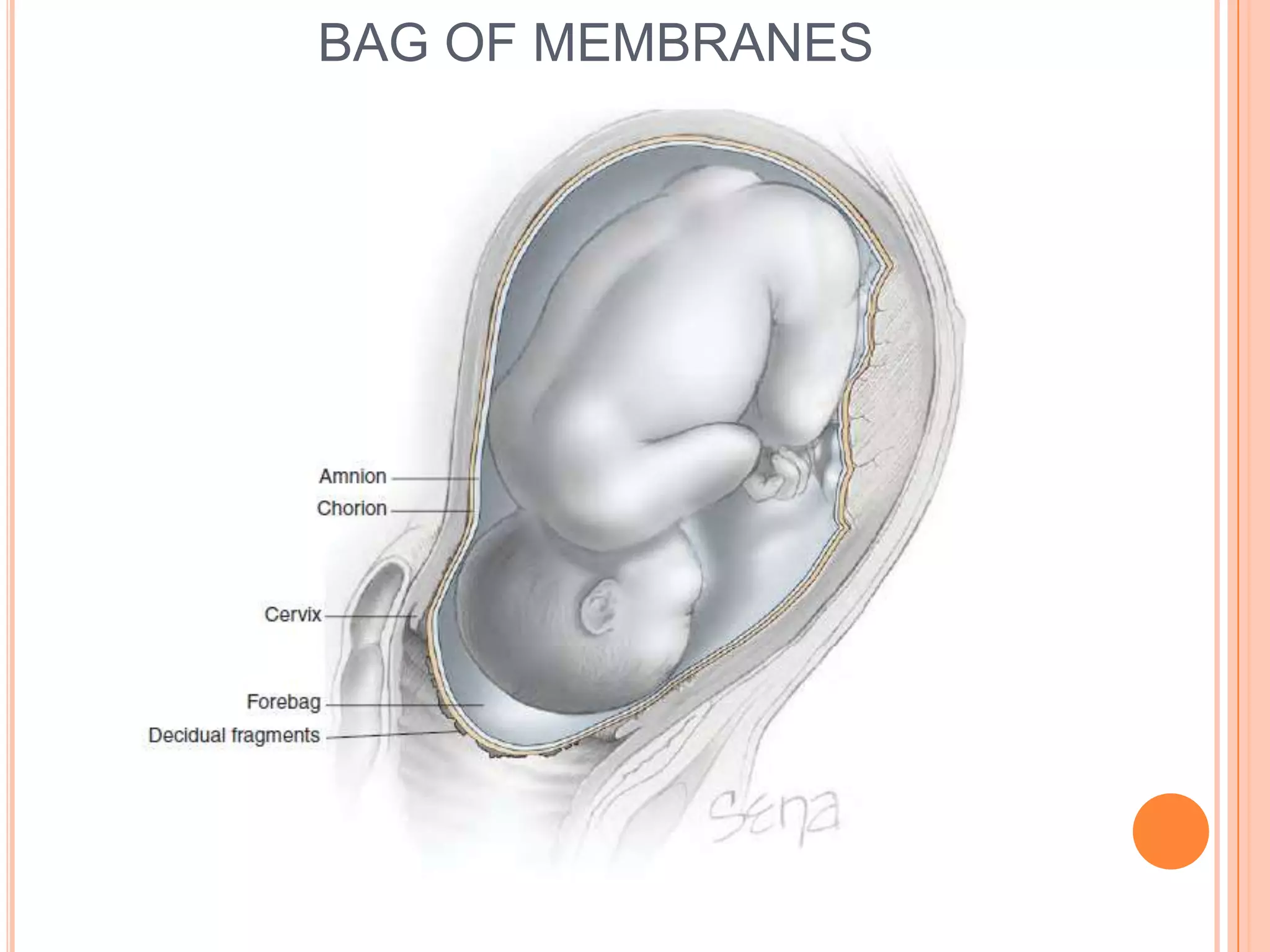 BAG OF MEMBRANES
 
