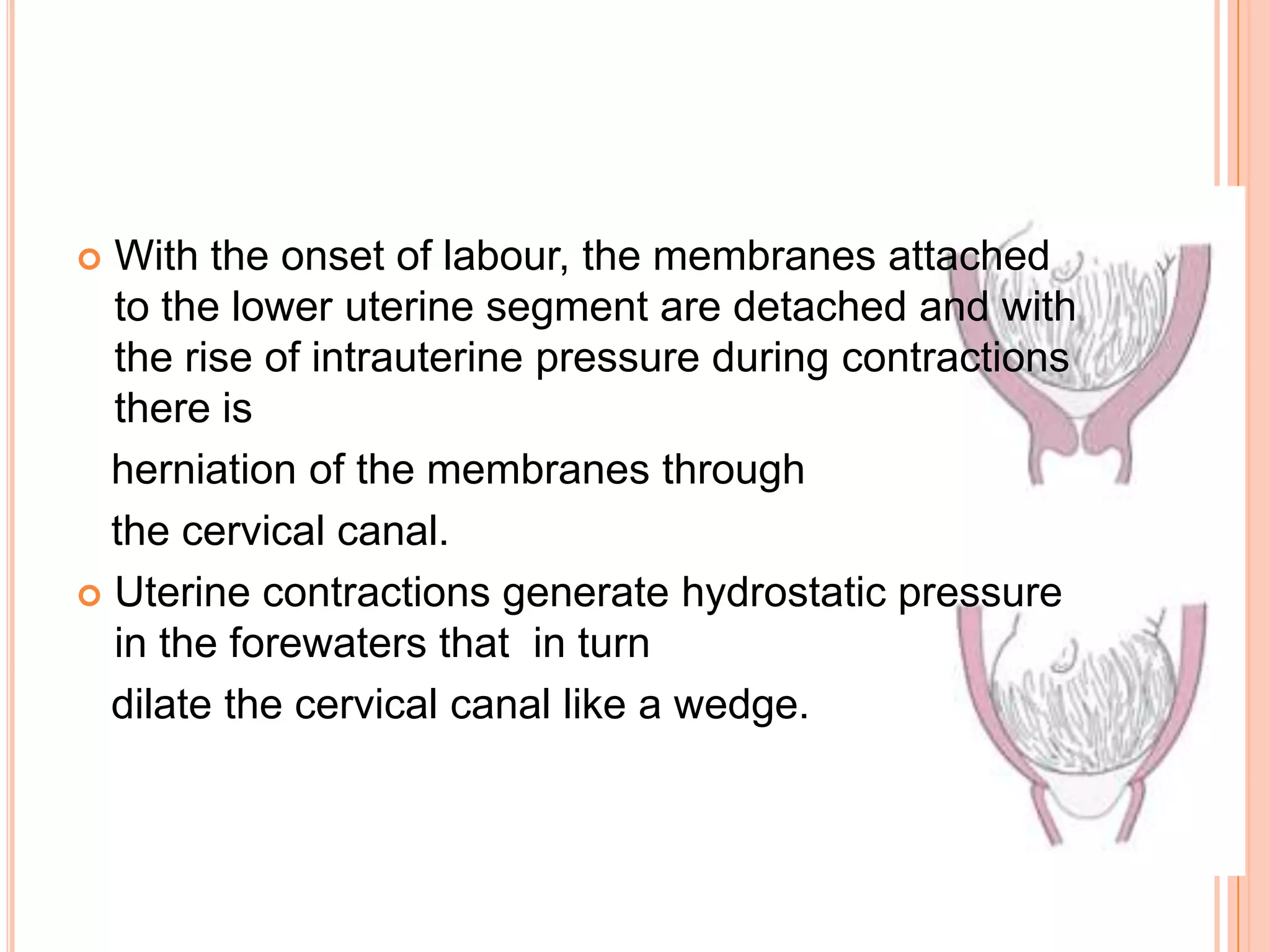  With the onset of labour, the membranes attached
to the lower uterine segment are detached and with
the rise of intrauterine pressure during contractions
there is
herniation of the membranes through
the cervical canal.
 Uterine contractions generate hydrostatic pressure
in the forewaters that in turn
dilate the cervical canal like a wedge.
 