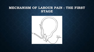 MECHANISM OF LABOUR PAIN : THE FIRST 
STAGE 
 