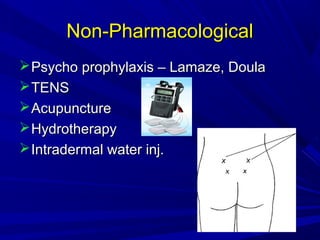 Non-Pharmacological
 Psycho prophylaxis – Lamaze, Doula
 TENS
 Acupuncture
 Hydrotherapy
 Intradermal water inj.

 