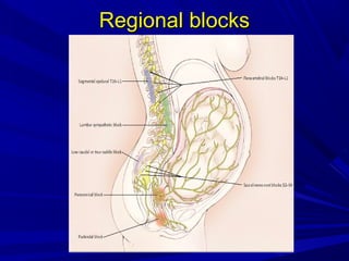 Regional blocks

 