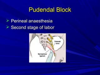 Pudendal Block
 Perineal anaesthesia
 Second stage of labor

 