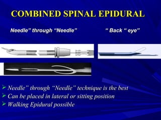COMBINED SPINAL EPIDURAL
Needle” through “Needle”

“ Back “ eye”

 Needle” through “Needle” technique is the best
 Can be placed in lateral or sitting position
 Walking Epidural possible

 