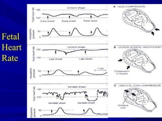 Fetal
Heart
Rate

 