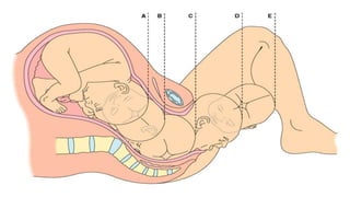 Labour and delivery | PPTX