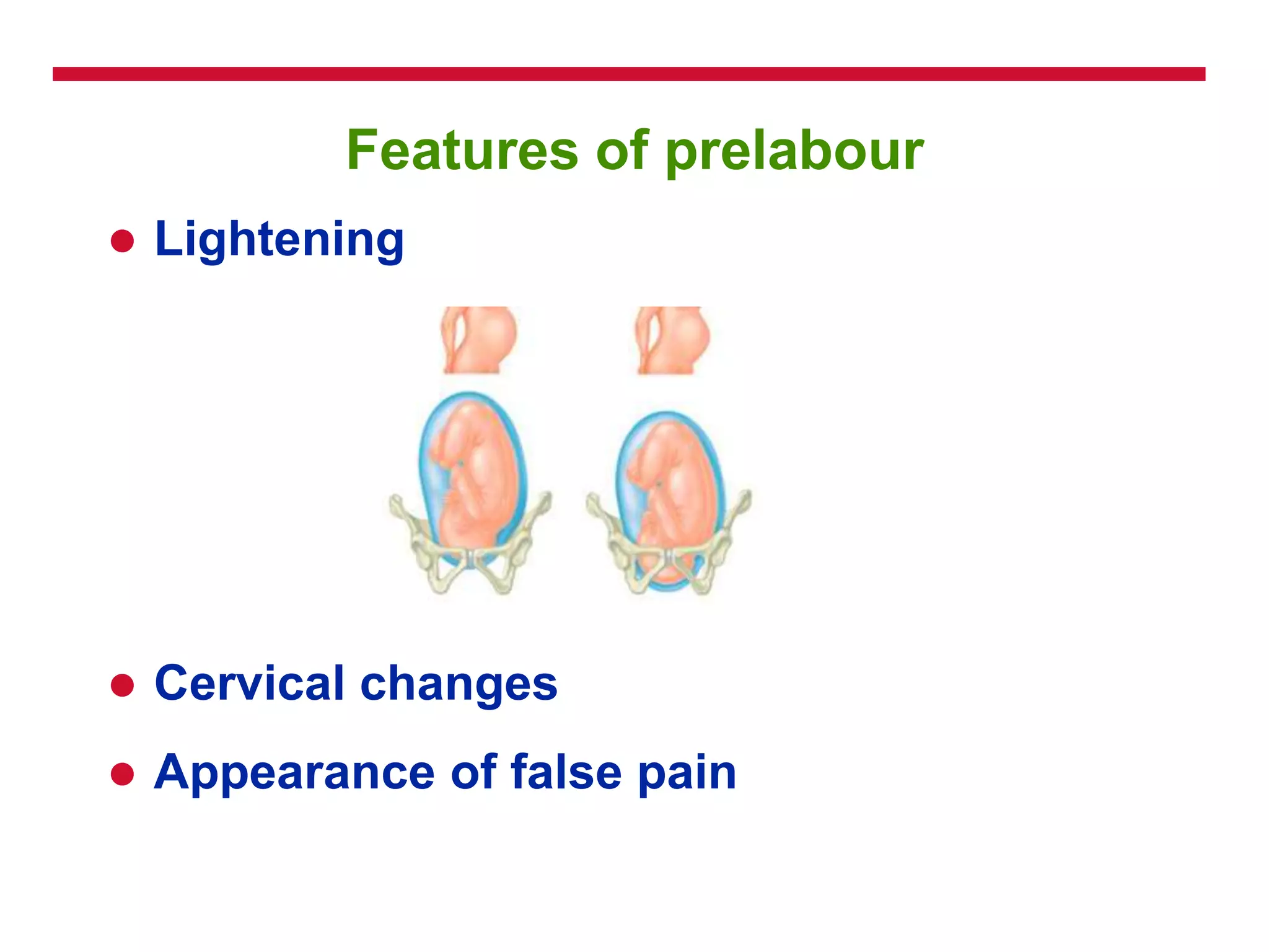 Features of prelabour
 Lightening
 Cervical changes
 Appearance of false pain
 