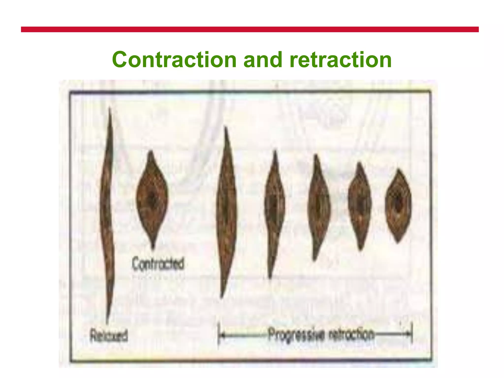 Contraction and retraction
 