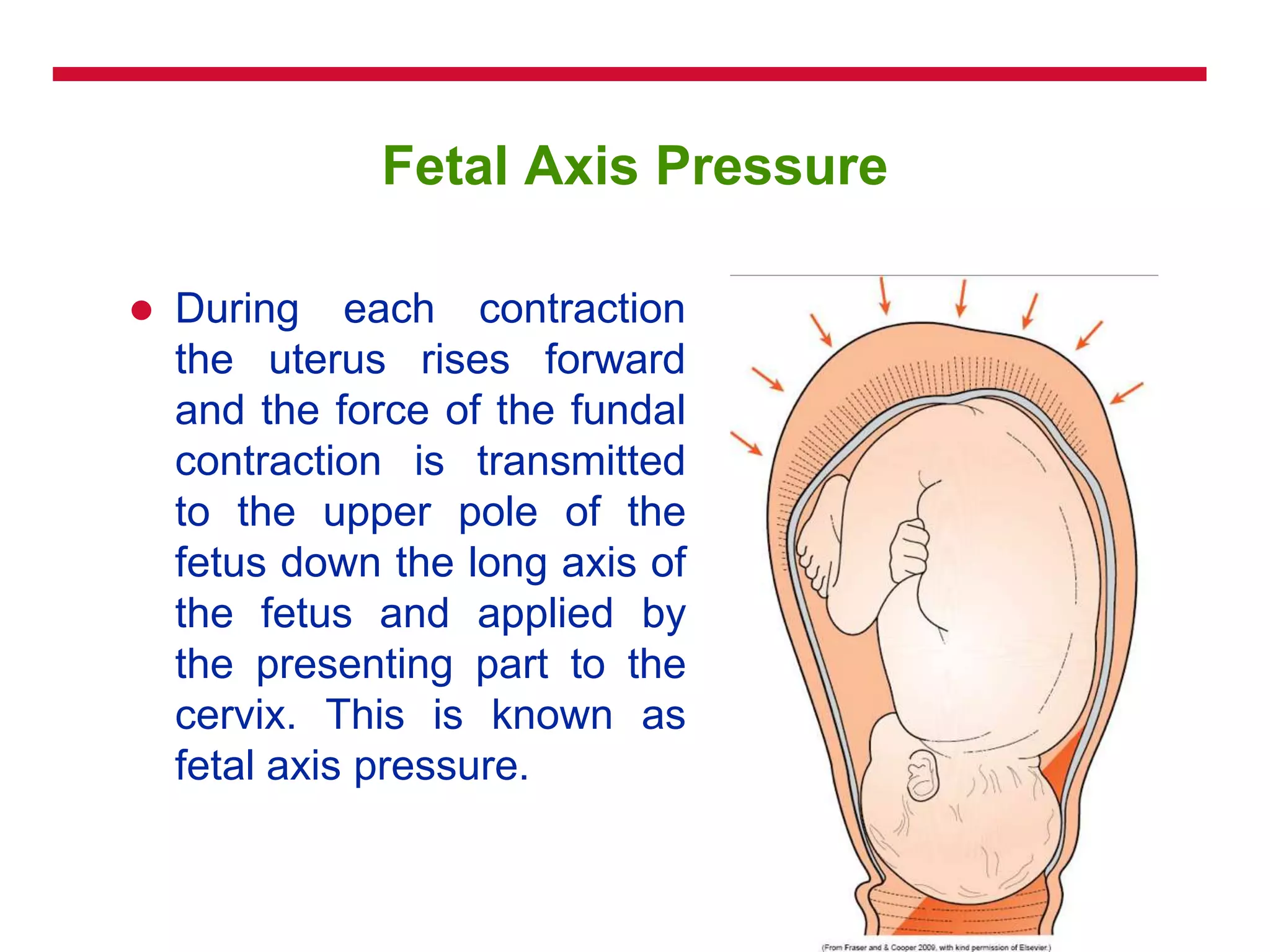 Fetal Axis Pressure
 During each contraction
the uterus rises forward
and the force of the fundal
contraction is transmitted
to the upper pole of the
fetus down the long axis of
the fetus and applied by
the presenting part to the
cervix. This is known as
fetal axis pressure.
 