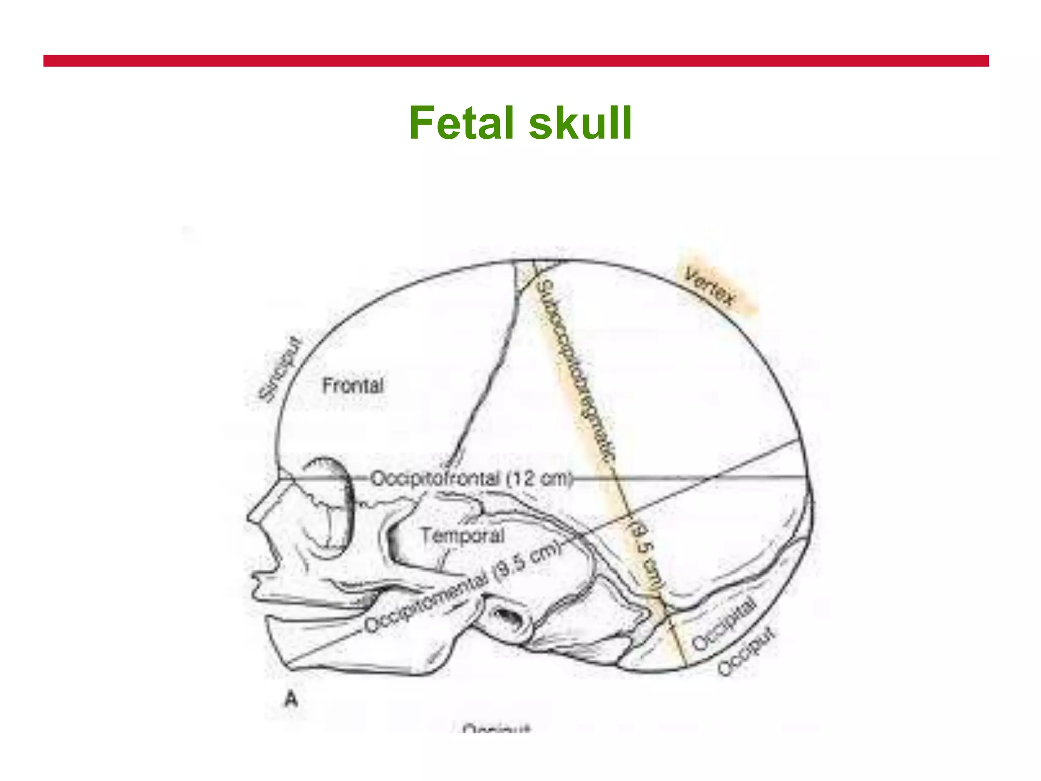 Fetal skull
 