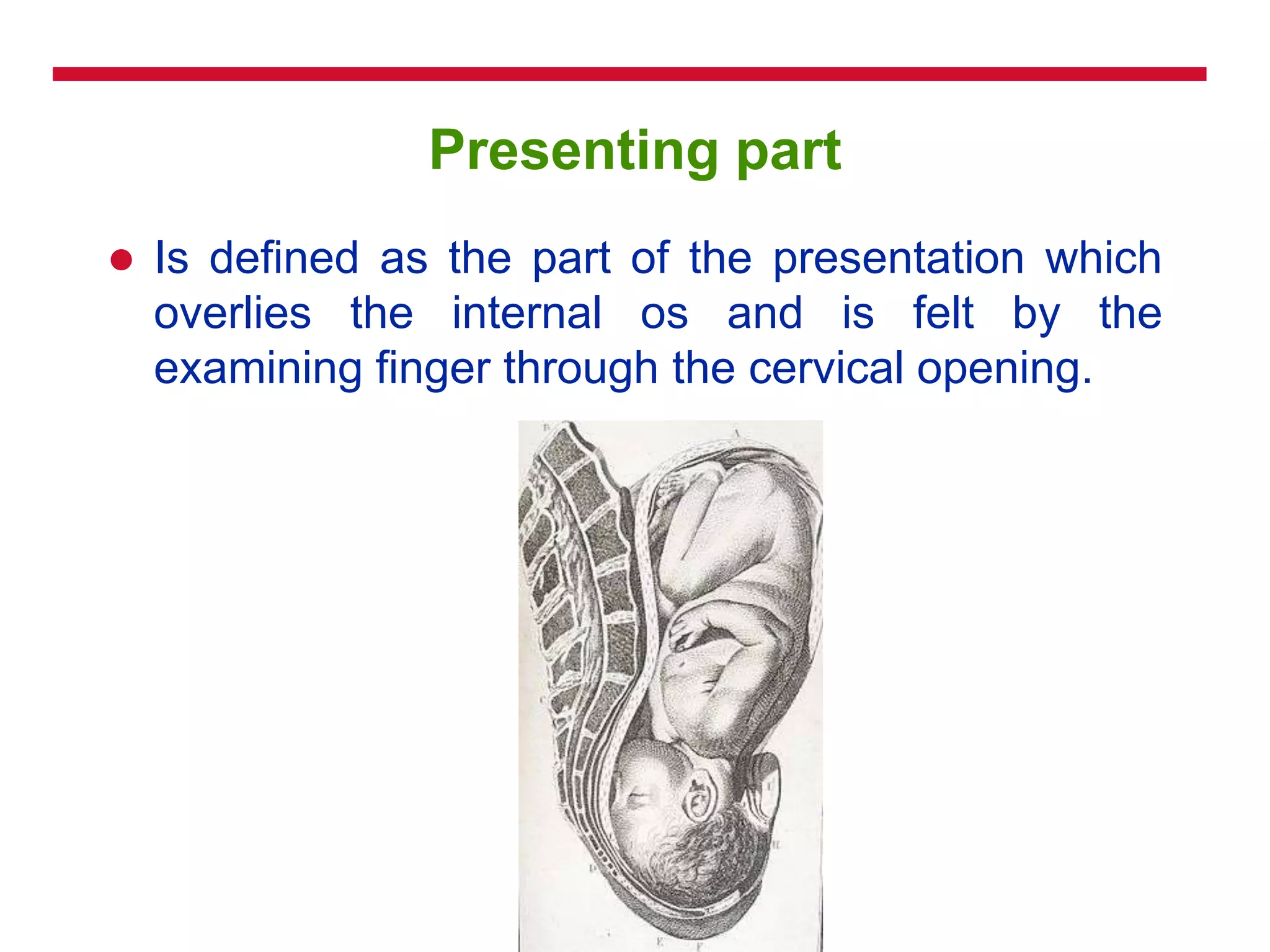 Presenting part
 Is defined as the part of the presentation which
overlies the internal os and is felt by the
examining finger through the cervical opening.
 