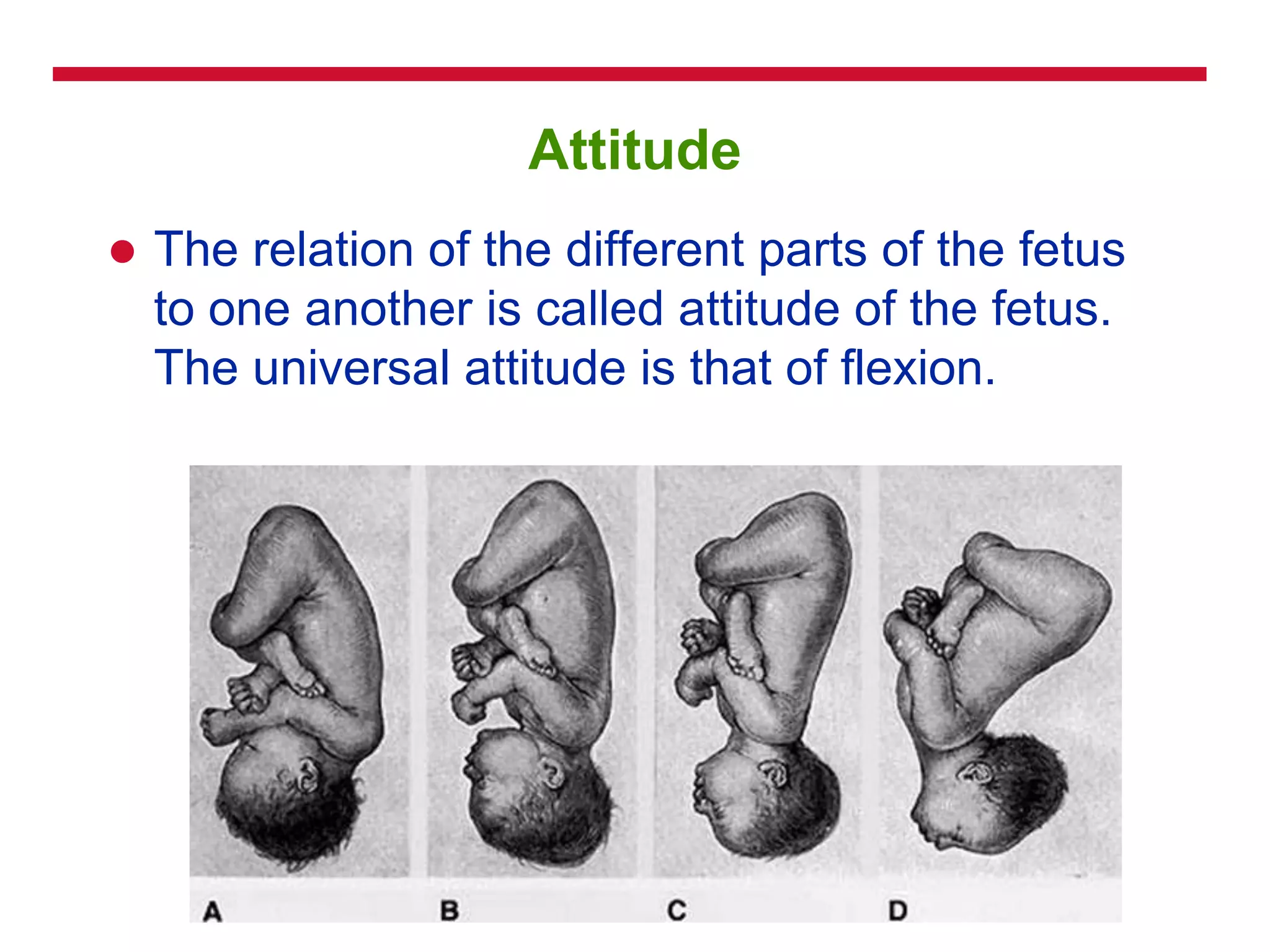 Attitude
 The relation of the different parts of the fetus
to one another is called attitude of the fetus.
The universal attitude is that of flexion.
 