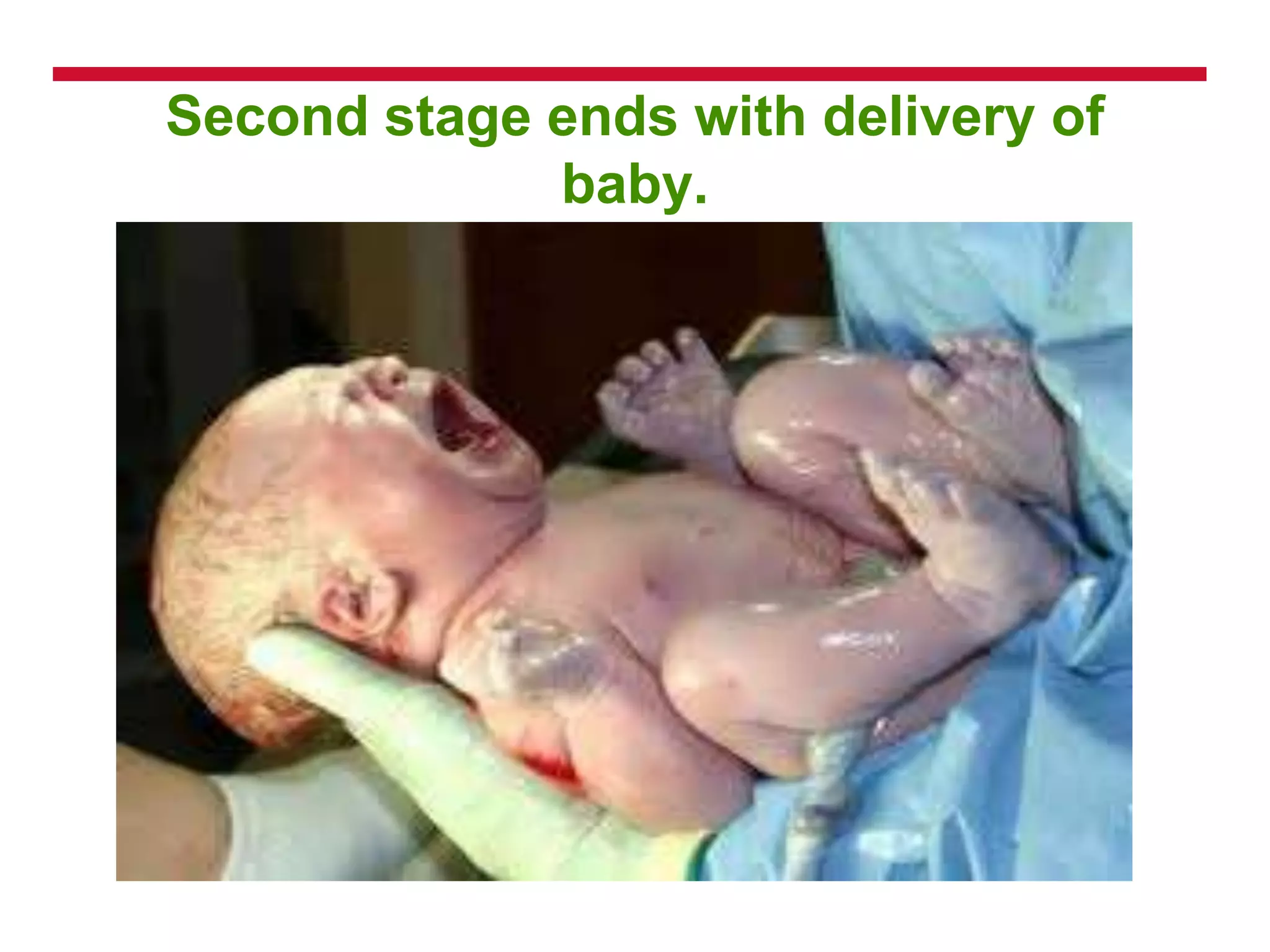 Second stage ends with delivery of
baby.
 