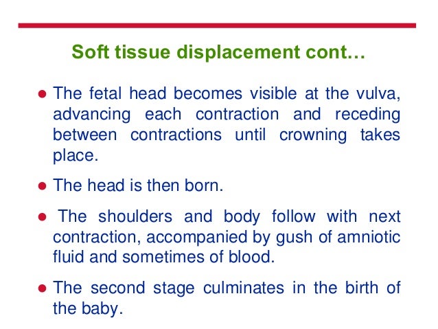 Labour And Its Stages Labour And Its Stages