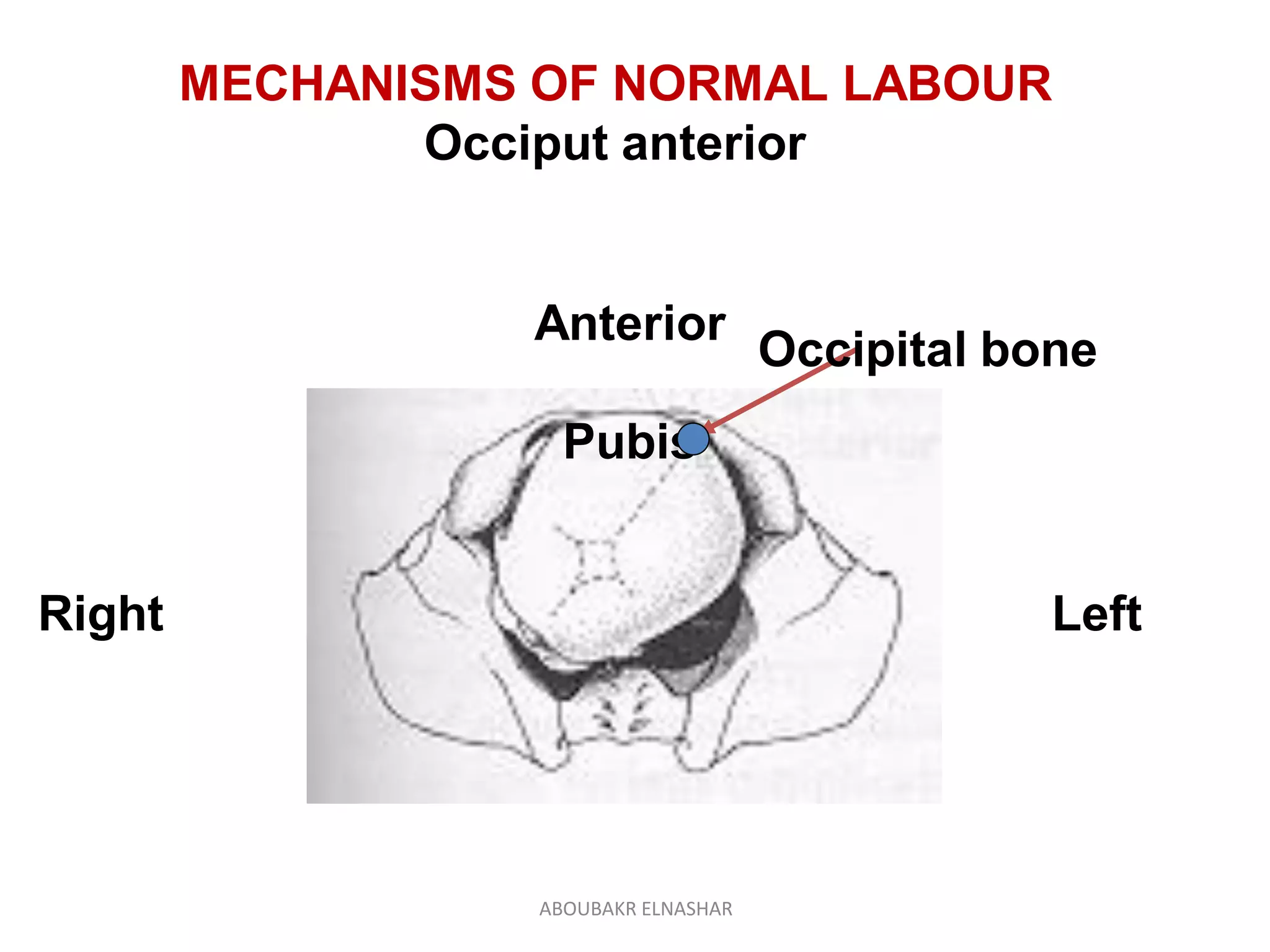 Management of normal labour | PDF